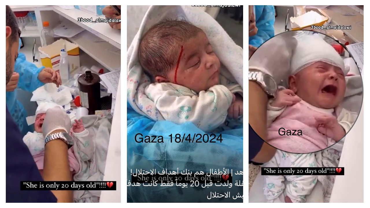 Dziewczynka, która urodziła się zaledwie 20 dni temu, była celem syjonistycznej armii okupacyjnej w Gazie.18/4/2024