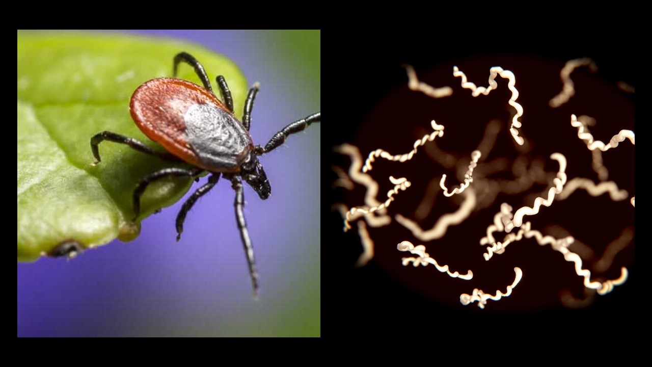 Choroba z Lyme , znana również jako borelioza z Lyme , jest chorobą odkleszczową wywoływaną przez bakterie Borrelia , przenoszone przez żywiące się krwią kleszcze z rodzaju Ixodes. Wpływ zmian klimatu na zdrowie.