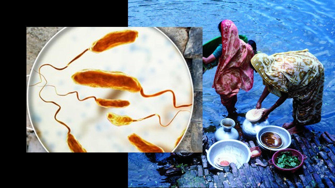 Cholera ( / ˈ k ɒ l ər ə / ) to zakażenie jelita cienkiego wywoływane przez niektóre szczepy bakterii Vibrio cholerae . Wpływ zmian klimatu na zdrowie.